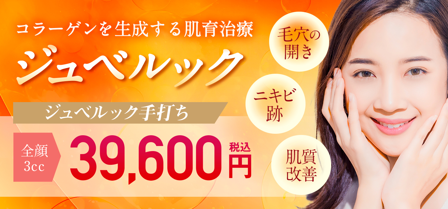 ジュベルック