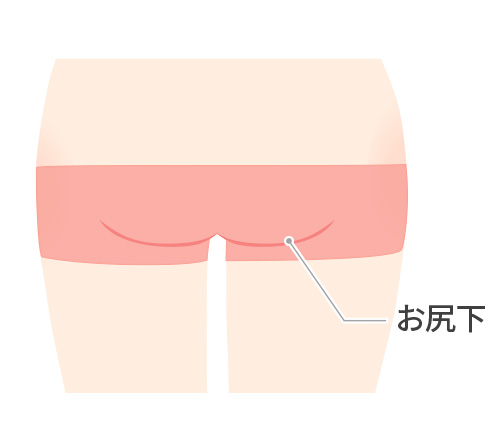 お尻下