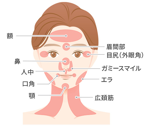 おでこ 目の下 鼻 口角 顎 眉間部 目尻（外眼角） エラ