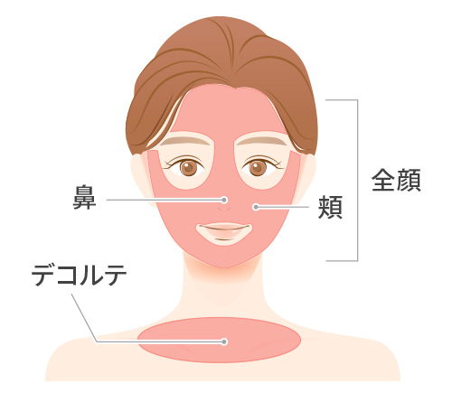 全顔・頬・鼻・デコルテ・背中