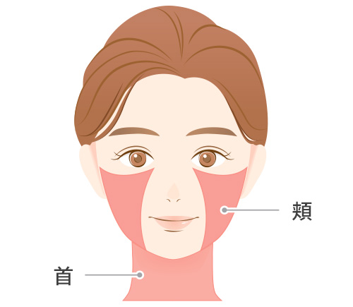 頬、首