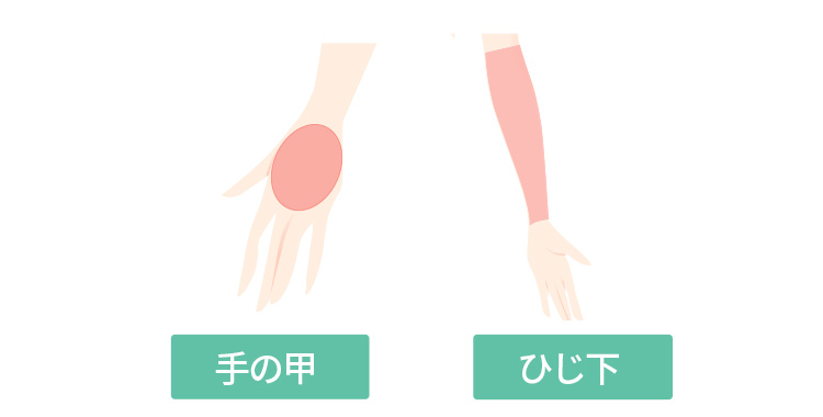 手の甲＋ひじ下