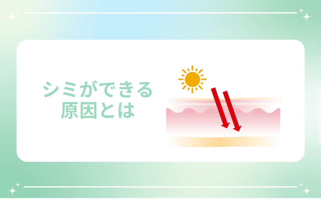 シミの原因と対策やシミの種類に適切な治療法をご紹介