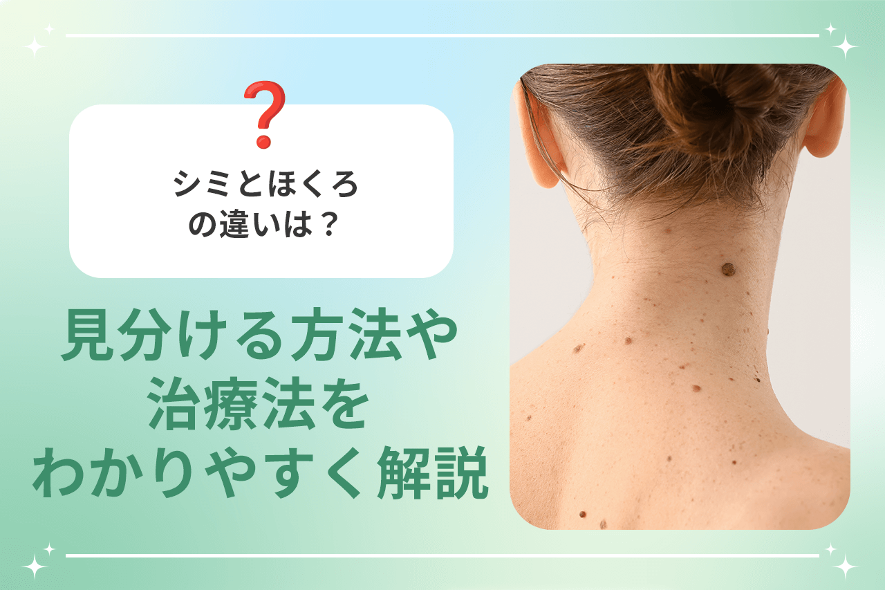 スキンタグとほくろの比較