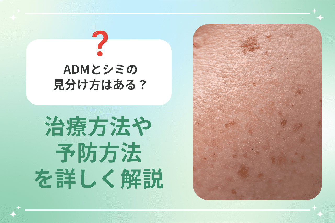 adm シミ 見分け方