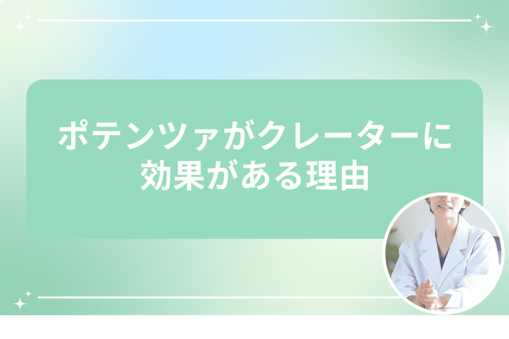 ポテンツァ クレーター 効果