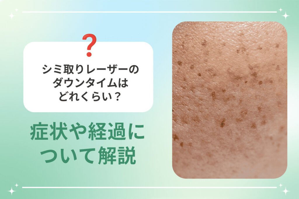 シミ取りレーザーのダウンタイムはどれくらい？症状や経過について解説 | 梅田すずらんクリニックブログ
