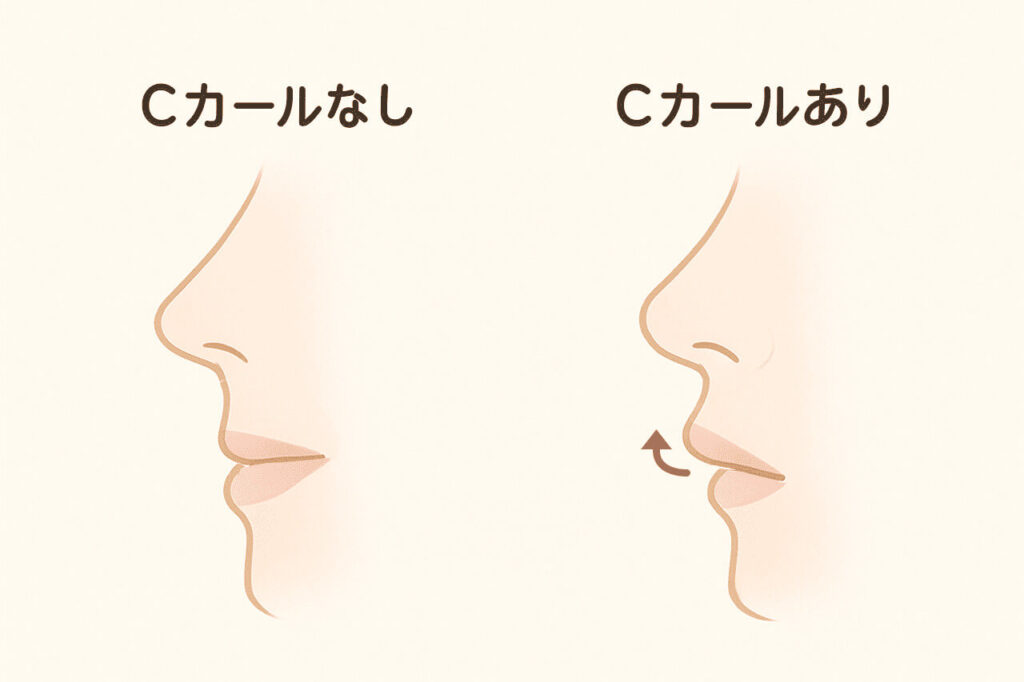 Cカールなしとありの鼻の比較