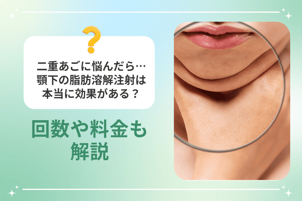 顎下の脂肪溶解注射と二重あごのクローズアップ画像