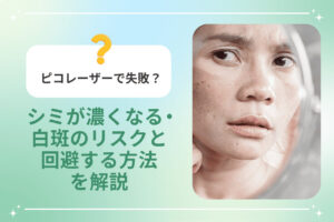 ピコレーザーの失敗リスクを解説する画像（シミに悩む女性の写真付き）