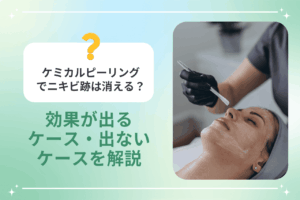 ケミカルピーリングの効果が出るケースと出ないケースを説明する画像