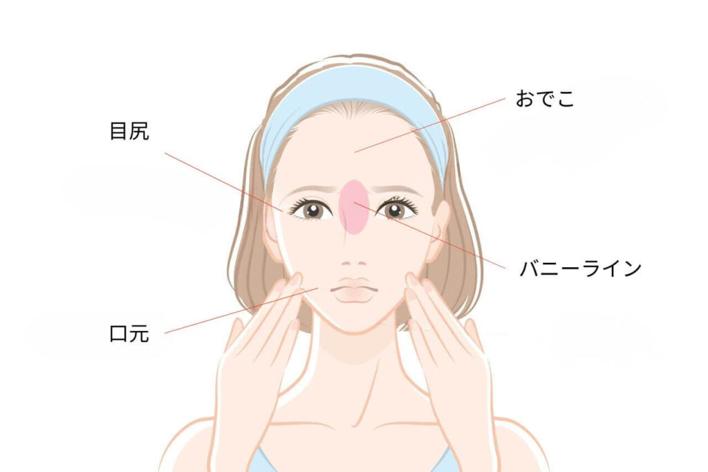 シワができる部位