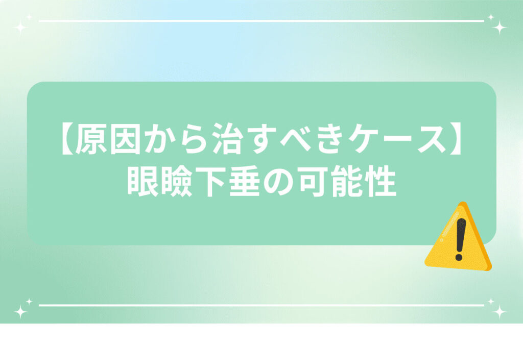 黄色の警告アイコン