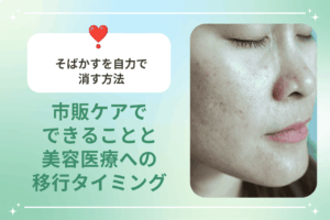 そばかすを自力で消す方法