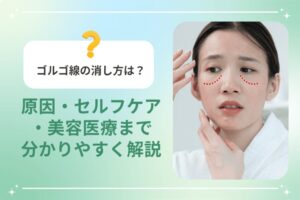 ゴルゴ線に悩む女性の頬に点線で位置を示したイメージ