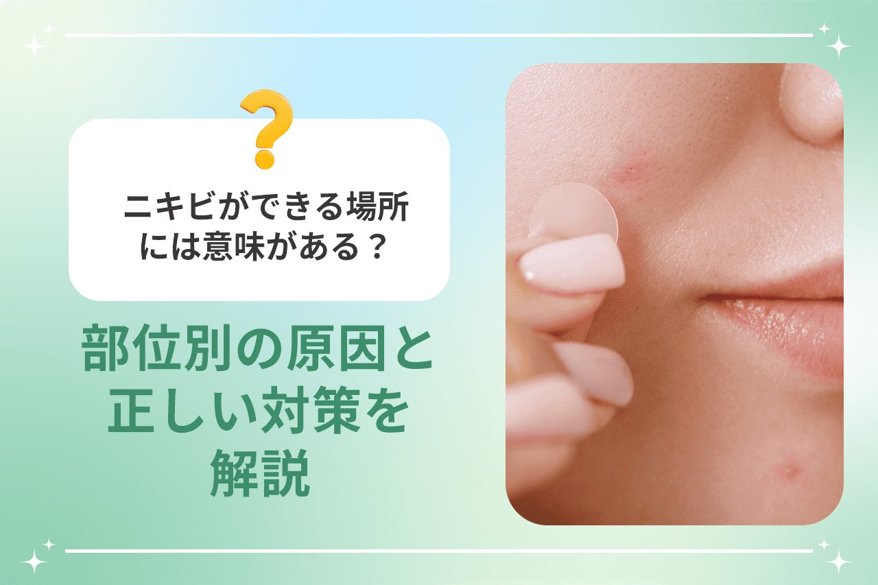 ニキビができる場所には意味がある？ 部位別の原因と正しい対策を解説