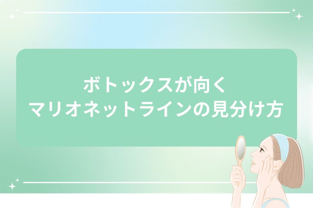 ボトックスが向くマリオネットラインの見分け方