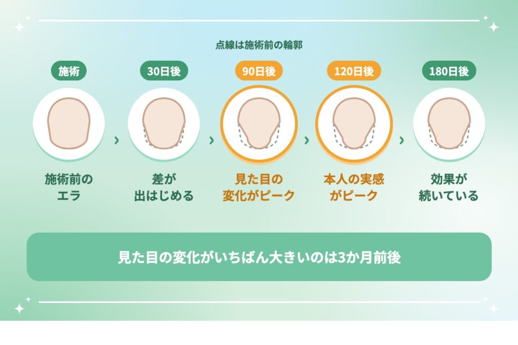 エラボトックスの経過