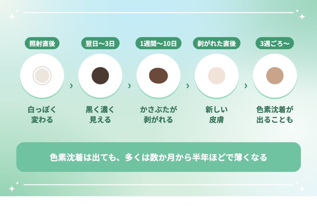 ピコスポットのダウンタイムの経過
