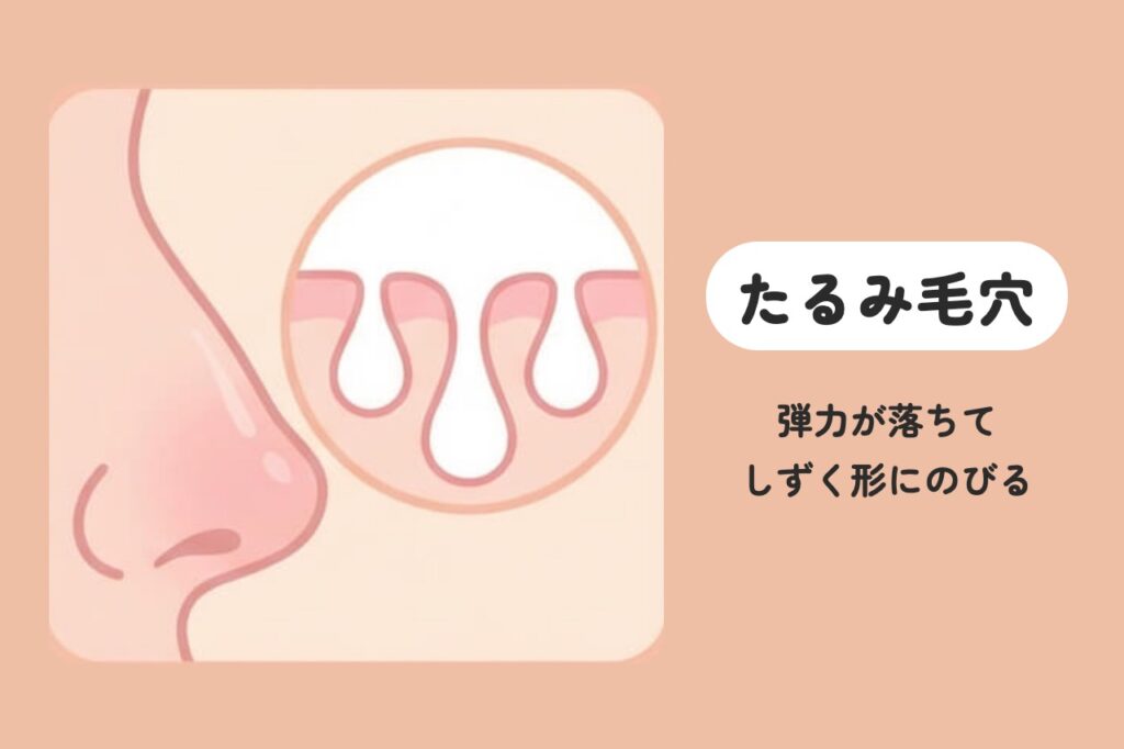たるみ毛穴