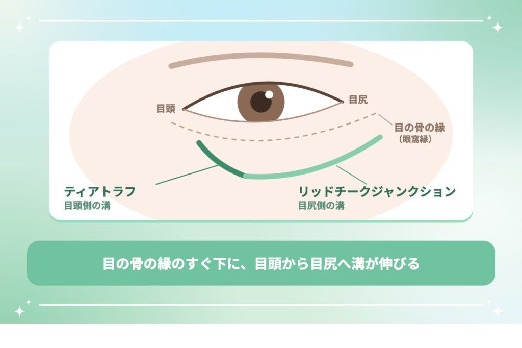 目の下のくぼみの原因